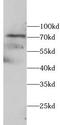 Probable ATP-dependent RNA helicase DHX58 antibody, FNab10709, FineTest, Western Blot image 