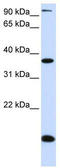 Kruppel Like Factor 8 antibody, TA344524, Origene, Western Blot image 