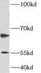 Histone-arginine methyltransferase CARM1 antibody, FNab01275, FineTest, Western Blot image 