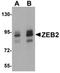 Zinc Finger E-Box Binding Homeobox 2 antibody, orb75451, Biorbyt, Western Blot image 