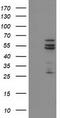 Cytochrome P450 Family 2 Subfamily C Member 9 antibody, LS-C173446, Lifespan Biosciences, Western Blot image 