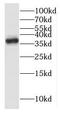 Intelectin-1 antibody, FNab04415, FineTest, Western Blot image 