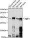 Zinc Finger Protein 541 antibody, 16-093, ProSci, Western Blot image 