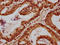 Forkhead Box A3 antibody, LS-C680489, Lifespan Biosciences, Immunohistochemistry paraffin image 
