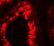 Y-Box Binding Protein 2 antibody, NBP1-76283, Novus Biologicals, Immunofluorescence image 