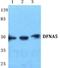 Non-syndromic hearing impairment protein 5 antibody, A32407, Boster Biological Technology, Western Blot image 