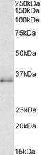 CCAAT Enhancer Binding Protein Beta antibody, STJ73004, St John