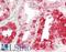 Neural EGFL Like 2 antibody, LS-B14656, Lifespan Biosciences, Immunohistochemistry paraffin image 