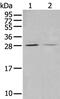 StAR-related lipid transfer protein 4 antibody, PA5-67611, Invitrogen Antibodies, Western Blot image 
