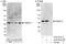 Proteasome 26S Subunit, Non-ATPase 13 antibody, A303-831A, Bethyl Labs, Western Blot image 