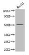 Phospholipase A2 Group VII antibody, LS-C285679, Lifespan Biosciences, Western Blot image 