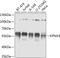 Karyopherin Subunit Alpha 3 antibody, GTX55685, GeneTex, Western Blot image 