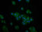 6-Phosphofructo-2-Kinase/Fructose-2,6-Biphosphatase 4 antibody, LS-C669650, Lifespan Biosciences, Immunofluorescence image 