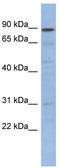 NFKB Inhibitor Like 1 antibody, TA343495, Origene, Western Blot image 