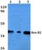 Homeobox B2 antibody, PA5-36595, Invitrogen Antibodies, Western Blot image 