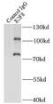 E2F Transcription Factor 8 antibody, FNab02604, FineTest, Immunoprecipitation image 