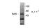 Retinoic Acid Receptor Beta antibody, NB200-323, Novus Biologicals, Western Blot image 