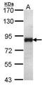 Forkhead Box K2 antibody, GTX104848, GeneTex, Western Blot image 