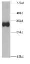 Prostaglandin D2 Synthase antibody, FNab06914, FineTest, Western Blot image 