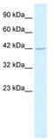 Heat Shock Transcription Factor 2 Binding Protein antibody, TA338116, Origene, Western Blot image 