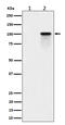 Nucleolin antibody, P00228, Boster Biological Technology, Western Blot image 