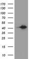 Alpha-Methylacyl-CoA Racemase antibody, TA800851BM, Origene, Western Blot image 
