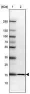 Ribosomal Protein S23 antibody, PA5-63032, Invitrogen Antibodies, Western Blot image 