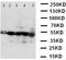 Branched Chain Amino Acid Transaminase 2 antibody, LS-C312658, Lifespan Biosciences, Western Blot image 
