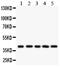 HLA class I histocompatibility antigen, Cw-7 alpha chain antibody, PA5-79367, Invitrogen Antibodies, Western Blot image 
