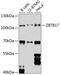 Zinc Finger And BTB Domain Containing 17 antibody, 23-600, ProSci, Western Blot image 