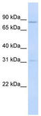Protein O-Mannosyltransferase 1 antibody, TA335942, Origene, Western Blot image 