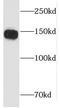 La Ribonucleoprotein Domain Family Member 1 antibody, FNab04698, FineTest, Western Blot image 