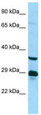 Trace Amine Associated Receptor 6 antibody, TA337761, Origene, Western Blot image 