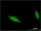 Centromere Protein V antibody, H00201161-M05, Novus Biologicals, Immunocytochemistry image 