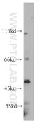 Nuclear Transcription Factor Y Subunit Gamma antibody, 10129-2-AP, Proteintech Group, Western Blot image 