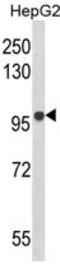 B Cell Scaffold Protein With Ankyrin Repeats 1 antibody, AP17897PU-N, Origene, Western Blot image 
