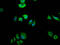 FAS antibody, CSB-RA240595A0HU, Cusabio, Immunofluorescence image 