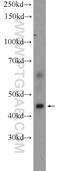 Purinergic Receptor P2Y13 antibody, 20335-1-AP, Proteintech Group, Western Blot image 