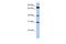 Dehydrogenase/Reductase X-Linked antibody, A13873, Boster Biological Technology, Western Blot image 
