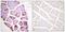 Ribosomal Protein S6 antibody, PA5-38330, Invitrogen Antibodies, Immunohistochemistry paraffin image 