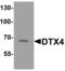 Deltex E3 Ubiquitin Ligase 4 antibody, NBP2-81924, Novus Biologicals, Western Blot image 