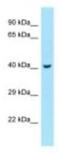 Rab Interacting Lysosomal Protein antibody, NBP1-98279, Novus Biologicals, Western Blot image 
