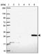 Chloride Intracellular Channel 2 antibody, PA5-63815, Invitrogen Antibodies, Western Blot image 