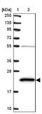 ATP Synthase Peripheral Stalk Subunit D antibody, NBP2-48906, Novus Biologicals, Western Blot image 
