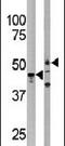 Protein Serine Kinase H1 antibody, PA5-13988, Invitrogen Antibodies, Western Blot image 