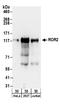 Receptor Tyrosine Kinase Like Orphan Receptor 2 antibody, A304-242A, Bethyl Labs, Western Blot image 