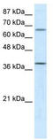 Acyl-CoA Dehydrogenase Medium Chain antibody, TA331168, Origene, Western Blot image 