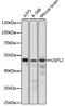 Ubiquitin carboxyl-terminal hydrolase 12 antibody, A08214, Boster Biological Technology, Western Blot image 