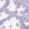 Coiled-Coil Domain Containing 151 antibody, PA5-62991, Invitrogen Antibodies, Immunohistochemistry frozen image 