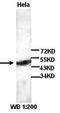 Nuclear Receptor Subfamily 1 Group H Member 4 antibody, orb77242, Biorbyt, Western Blot image 